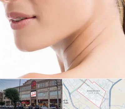 جراحی فک با لیزر در قائمیه اسلامشهر