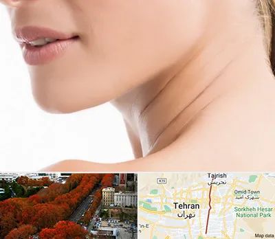 جراحی فک با لیزر در ولیعصر 