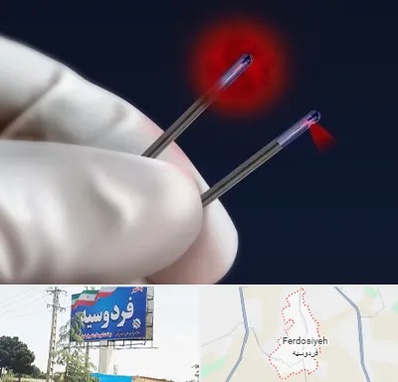 جراحی سینه با لیزر در فردوسیه شهریار