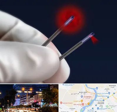 جراحی سینه با لیزر در کیانپارس اهواز