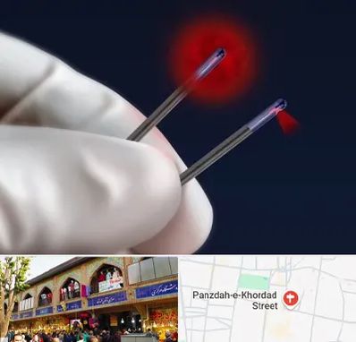 جراحی سینه با لیزر در 15 خرداد