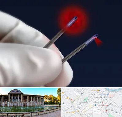 جراحی سینه با لیزر در عفیف آباد شیراز