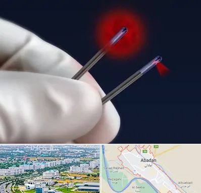 جراحی سینه با لیزر در آبادان