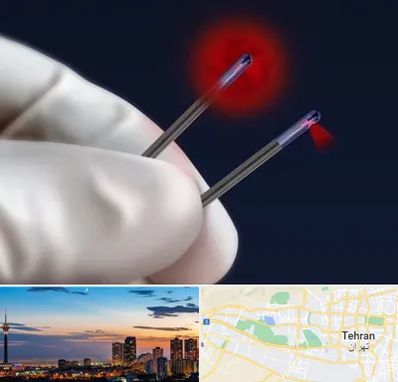 جراحی سینه با لیزر در غرب تهران 