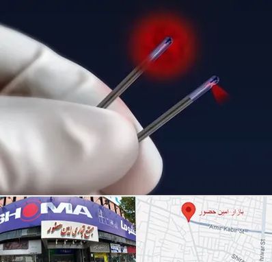 جراحی سینه با لیزر در امین حضور