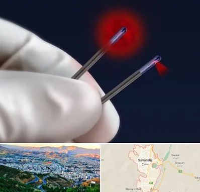 جراحی سینه با لیزر در سنندج