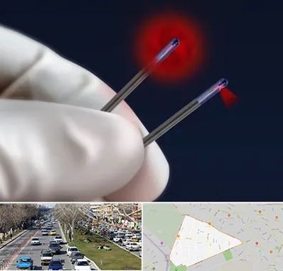 جراحی سینه با لیزر در احمدآباد مشهد