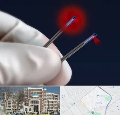 جراحی سینه با لیزر در طلاب مشهد