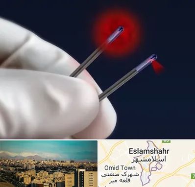 جراحی سینه با لیزر در اسلامشهر