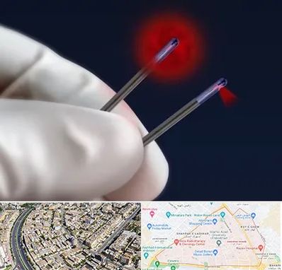 جراحی سینه با لیزر در شهرک غرب مشهد