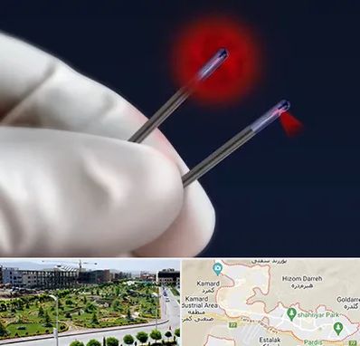 جراحی سینه با لیزر در پردیس