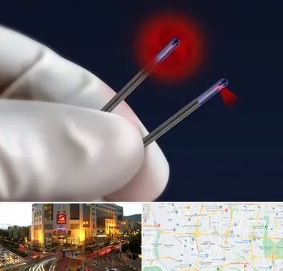 جراحی سینه با لیزر در جنت آباد تهران 