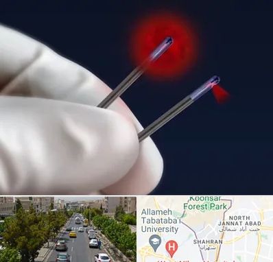 جراحی سینه با لیزر در شهران 