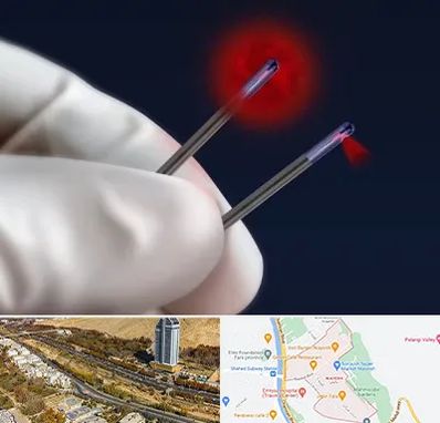 جراحی سینه با لیزر در خیابان نیایش شیراز