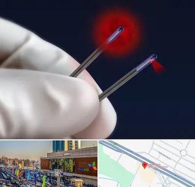 جراحی سینه با لیزر در لاله پارک تبریز