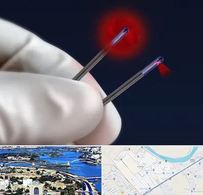 جراحی سینه با لیزر در کوروش اهواز