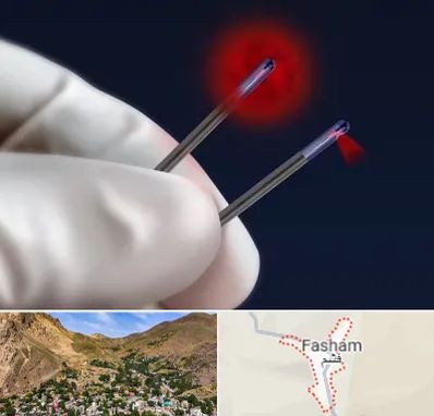 جراحی سینه با لیزر در فشم