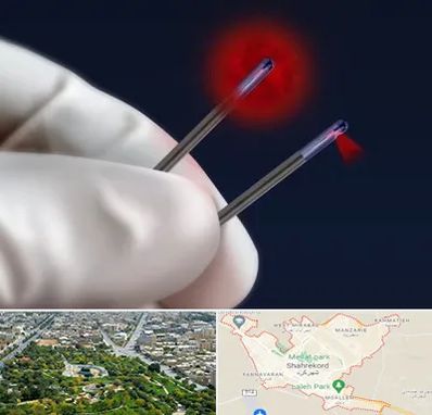 جراحی سینه با لیزر در شهرکرد