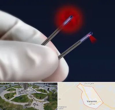 جراحی سینه با لیزر در ورامین