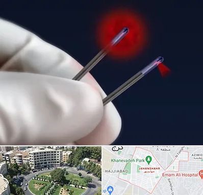 جراحی سینه با لیزر در جهانشهر کرج 