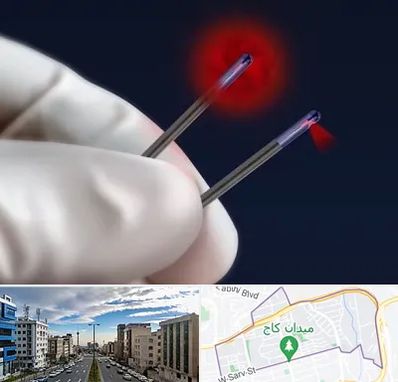 جراحی سینه با لیزر در سعادت آباد 