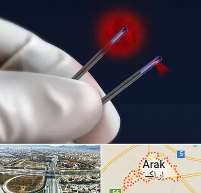 جراحی سینه با لیزر در اراک