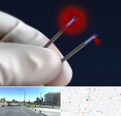 جراحی سینه با لیزر در بلوار کلاهدوز مشهد