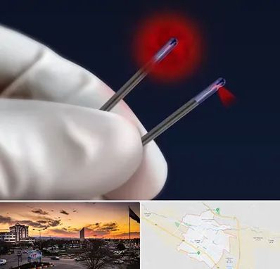 جراحی سینه با لیزر در قوچان