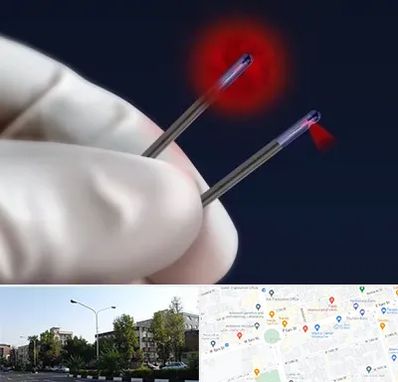 جراحی سینه با لیزر در میدان کاج 