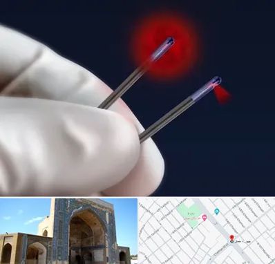 جراحی سینه با لیزر در مصلی مشهد