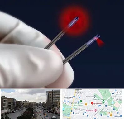 جراحی سینه با لیزر در بلوار فردوسی مشهد