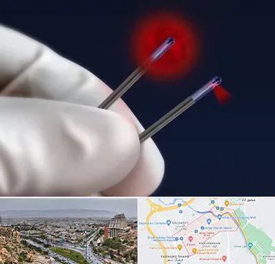 جراحی سینه با لیزر در معالی آباد شیراز