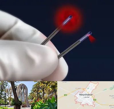 جراحی سینه با لیزر در نیشابور