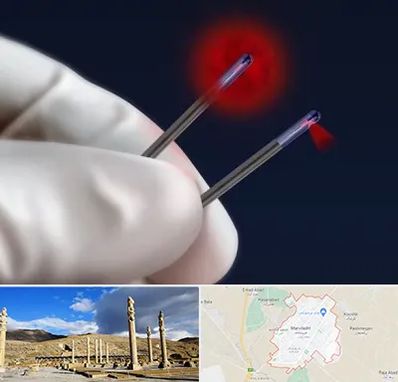 جراحی سینه با لیزر در مرودشت