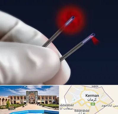 جراحی سینه با لیزر در کرمان