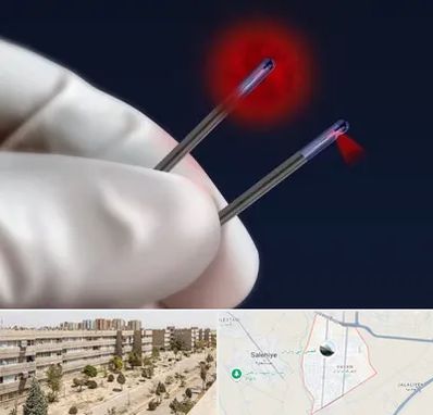 جراحی سینه با لیزر در واوان اسلامشهر