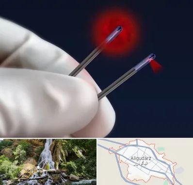 جراحی سینه با لیزر در الیگودرز