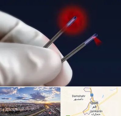 جراحی سینه با لیزر در قم