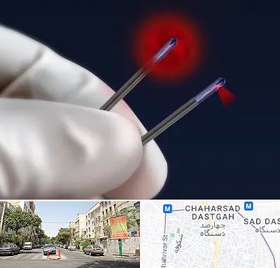 جراحی سینه با لیزر در چهارصد دستگاه 