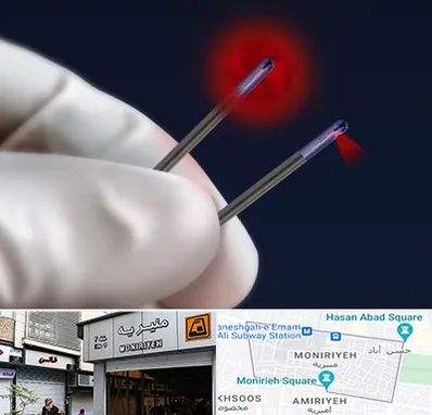 جراحی سینه با لیزر در منیریه 