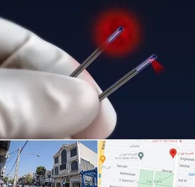 جراحی سینه با لیزر در افسریه 