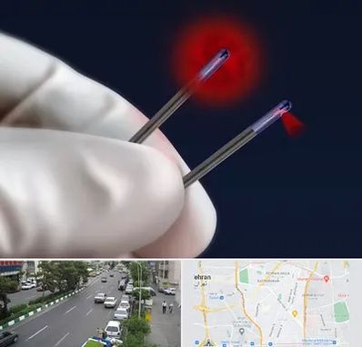 جراحی سینه با لیزر در ستارخان 