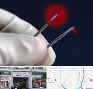 جراحی سینه با لیزر در ایران زمین