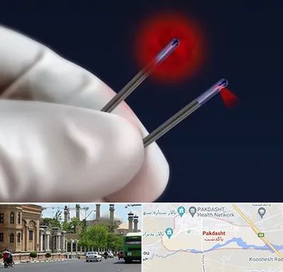 جراحی سینه با لیزر در پاکدشت