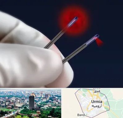 جراحی سینه با لیزر در ارومیه