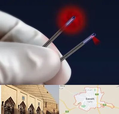 جراحی سینه با لیزر در ساوه