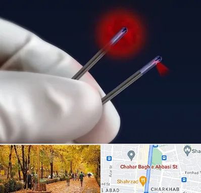 جراحی سینه با لیزر در چهارباغ اصفهان