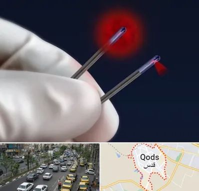 جراحی سینه با لیزر در شهر قدس