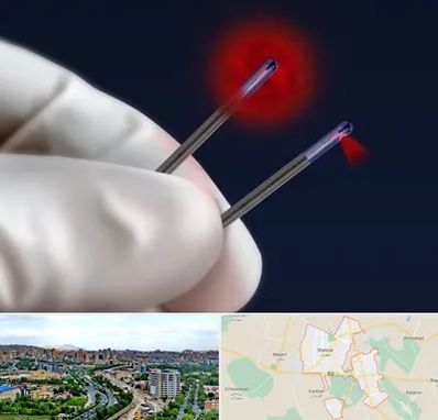 جراحی سینه با لیزر در شهریار