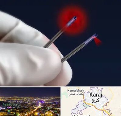 جراحی سینه با لیزر در کرج